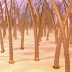 Выпадают волосы после пересадки