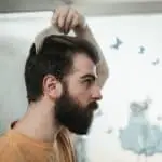 Методы пересадки волос: Как выбрать подходящий именно вам