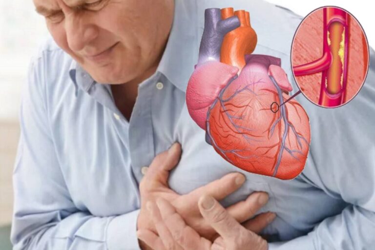 Yurak-qon tomir kasalliklarida zamonaviy diagnostika usullari