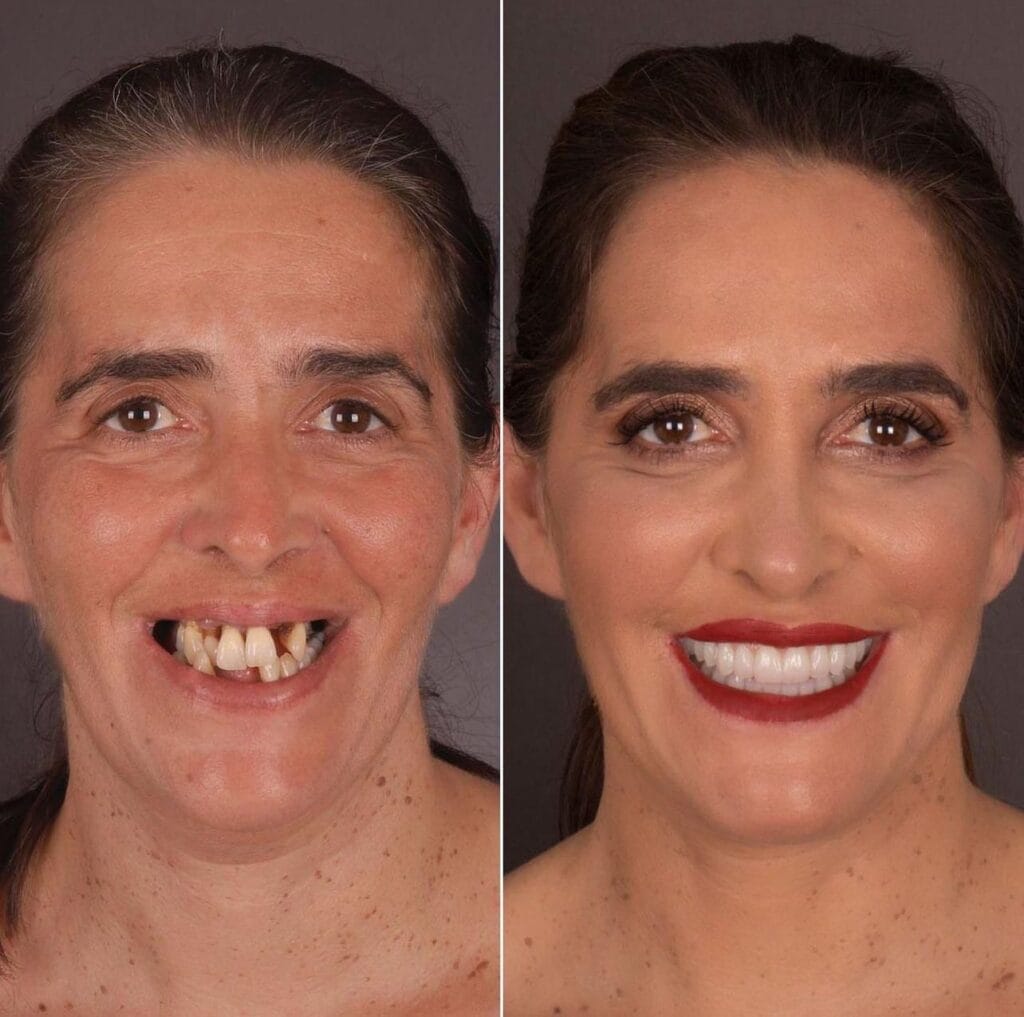 стоматология в турции