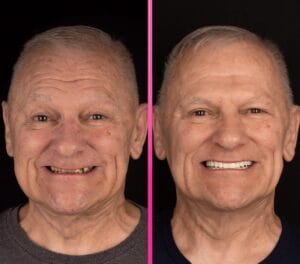 лечение зубов в турции