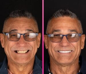 лечение зубов в турции