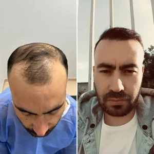 Docshair-Before-and- (5) Docshair-Before-and- (5)