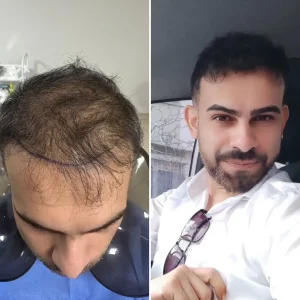 Docshair-Before-and- (6) Docshair-Before-and- (6)