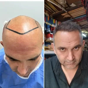 Docshair-Before-and- (7)