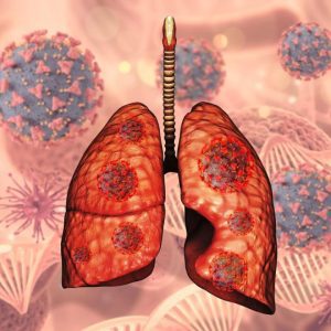 Что такое туберкулёз?