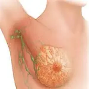 Рак груди. Когда всё вдруг меняется.