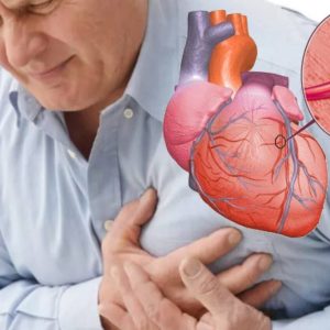 Yurak-qon tomir kasalliklarida zamonaviy diagnostika usullari`