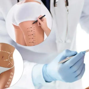 سحر الجراحة التجميلية في تركيا: كل ما تحتاج معرفته قبل اتخاذ القرار