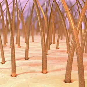 Выпадают волосы после пересадки? Не паникуйте!