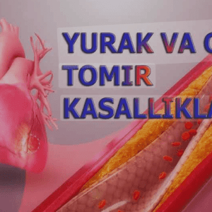Yurak-qon tomir kasalliklarining asosiy turlari va sabablari